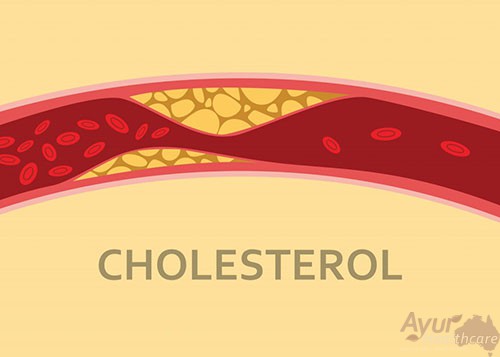 Cholestrol